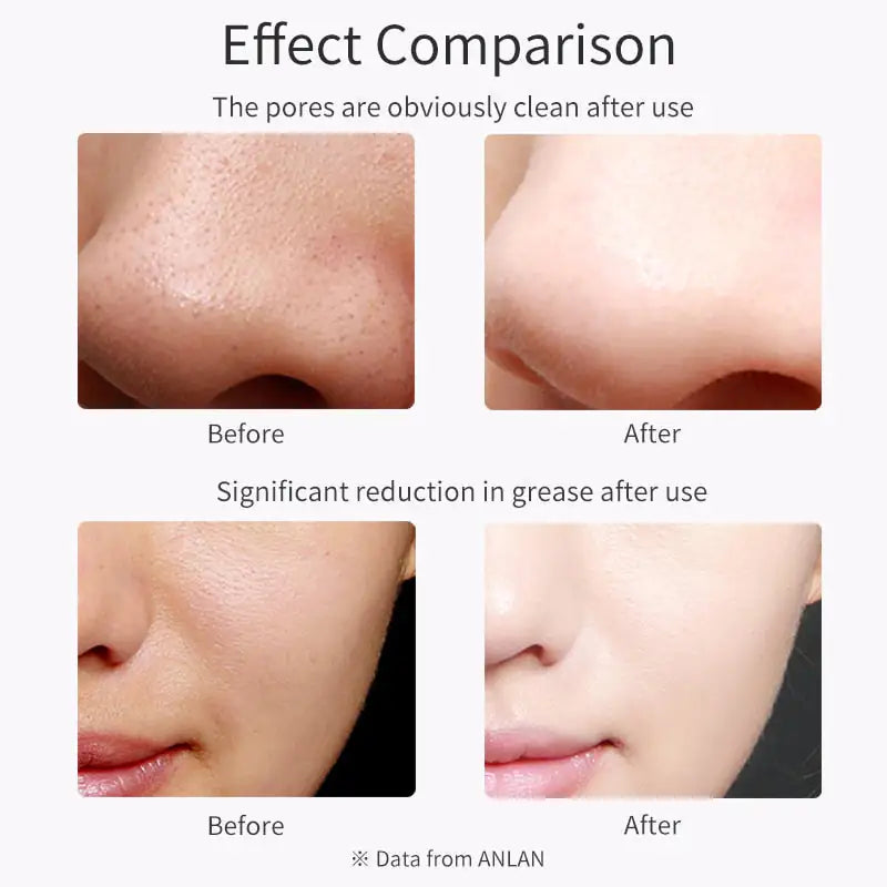 Ultraschall-Hautwäscher