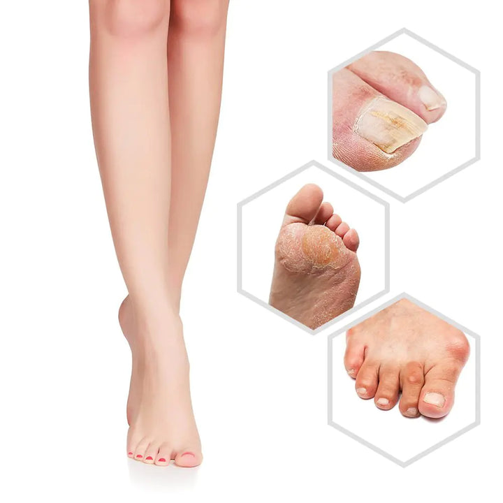 Electric Foot Grinder with Battery for Pedicure Care